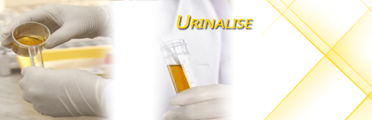 Urinálise